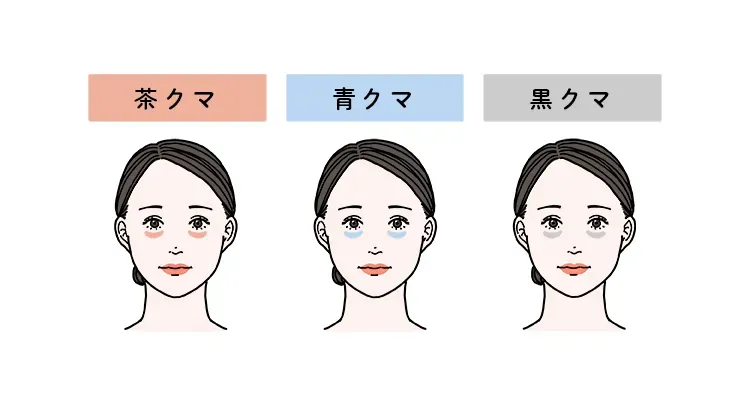クマの種類とコンシーラー選び