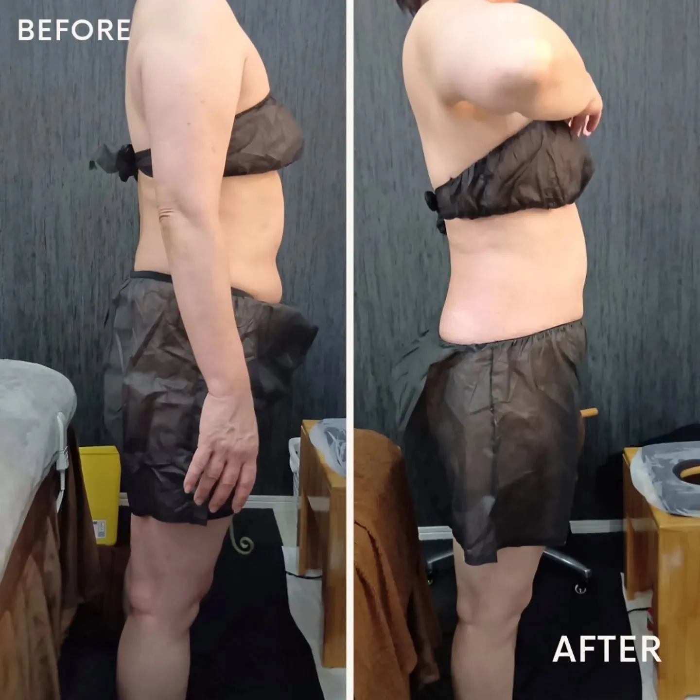 ✨新メニュー登場のお知らせ✨ みなさん、待望の「肋骨はがし＋...